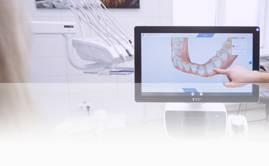 3D СКАНИРОВАНИЕ