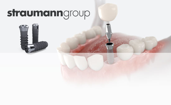 Преимум имплантация